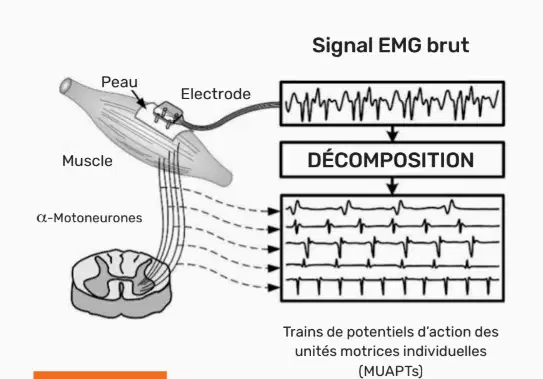 Schéma de décomposition d’un signal EMG brut en trains de potentiels d’action