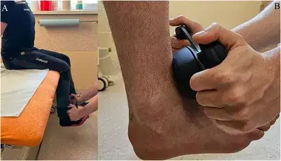 How to measure Muscle Strength? New Study Validates a Go-To Tool for Athletes and Rehab 2 Two demonstration photos from a clinical study showing a seated patient (A) and a close-up of a Kinvent handheld dynamometer being used to measure muscle strength at the ankle (B)