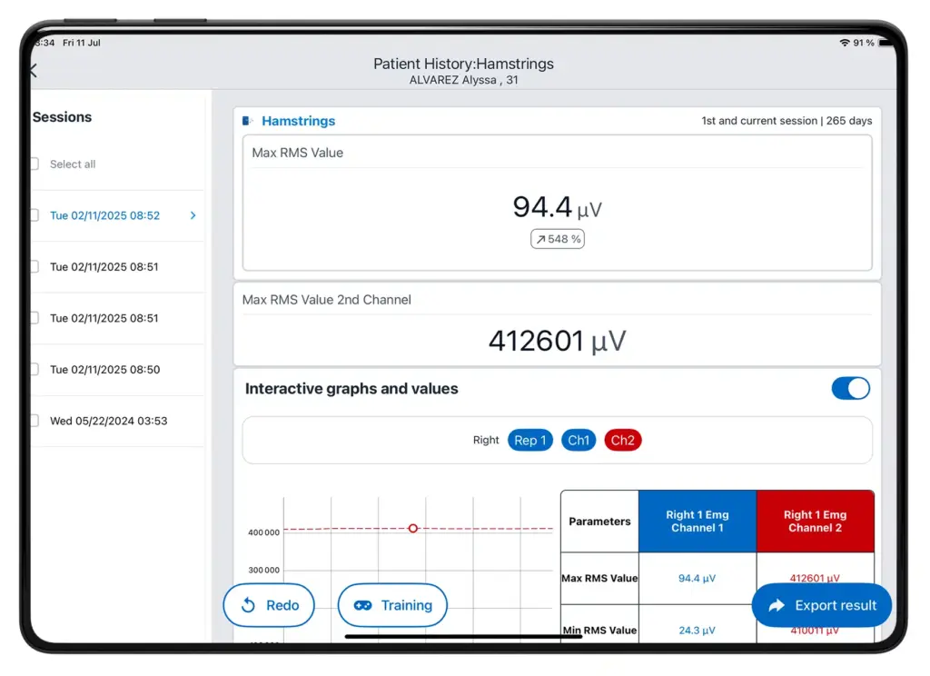 平板电脑屏幕显示 Kinvent App 针对 K-Myo 肌电图（EMG）腘绳肌评估的患者历史报告，展示了通道 1 最大 RMS 值为 94.4 微伏等数据指标以及一个交互式跟踪表格